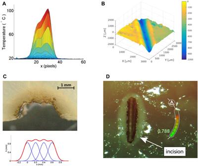 μRALP and Beyond: Micro-Technologies and Systems for Robot-Assisted Endoscopic Laser Microsurgery